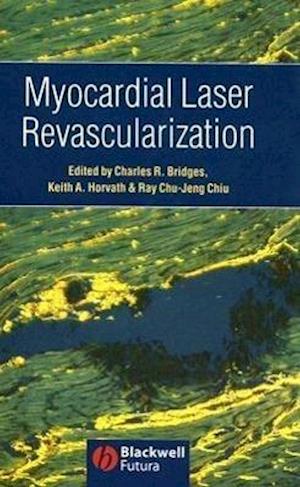 Myocardial Laser Revascularization