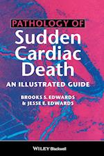 Pathology of Sudden Cardiac Death – An Illustrated  Guide