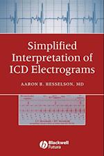 Simplified Interpretation of ICD Electrograms