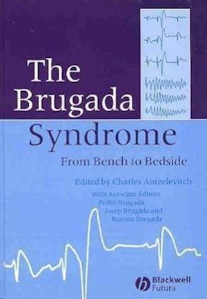 The Brugada Syndrome – From Bench to Bedside