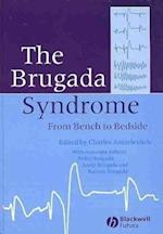 The Brugada Syndrome – From Bench to Bedside