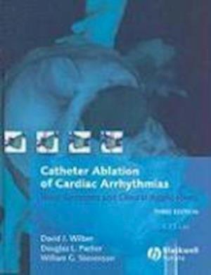 Catheter Ablation of Cardiac Arrhythmias