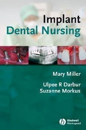 Implant Dental Nursing