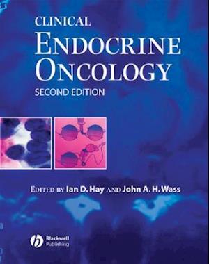 Clinical Endocrine Oncology