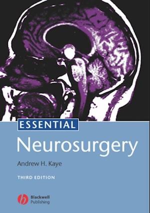 Essential Neurosurgery