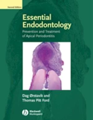 Essential Endodontology