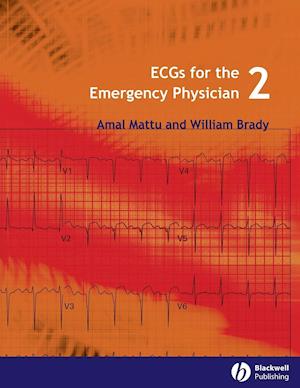ECGs for the Emergency Physician 2e