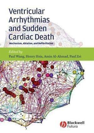 Ventricular Arrhythmias and Sudden Cardiac Death –  Mechanism, Ablation and Defibrillation