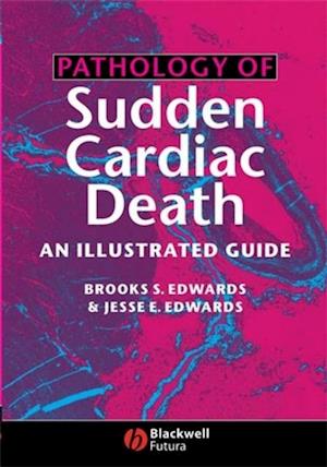 Pathology of Sudden Cardiac Death