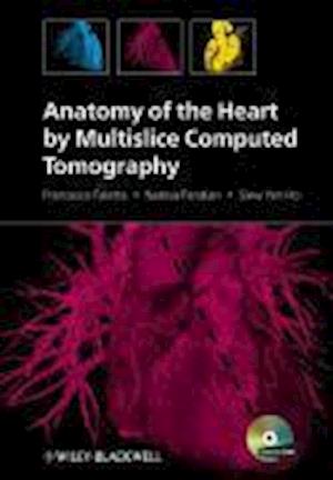 Anatomy of the Heart by Multislice Computed Tomography