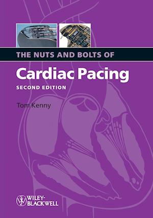 The Nuts and Bolts of Cardiac Pacing 2e