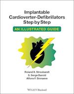 Implantable Cardioverter – Defibrillators Step by Step – An Illustrated Guide