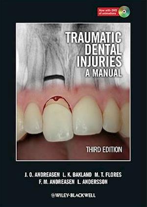 Traumatic Dental Injuries – A Manual 3e