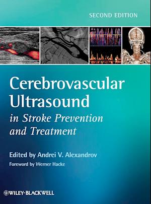 Cerebrovascular Ultrasound in Stroke Prevention and Treatment 2e