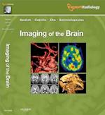 Imaging of the Brain