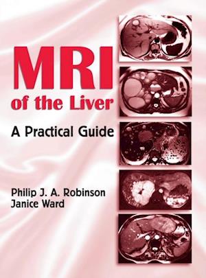 MRI of the Liver