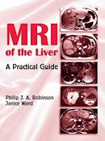 MRI of the Liver