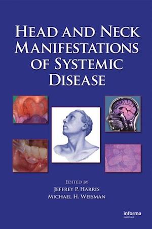 Head and Neck Manifestations of Systemic Disease