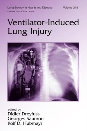 Ventilator-Induced Lung Injury