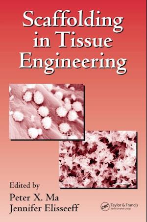 Scaffolding In Tissue Engineering