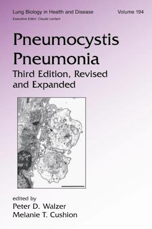 Pneumocystis Pneumonia