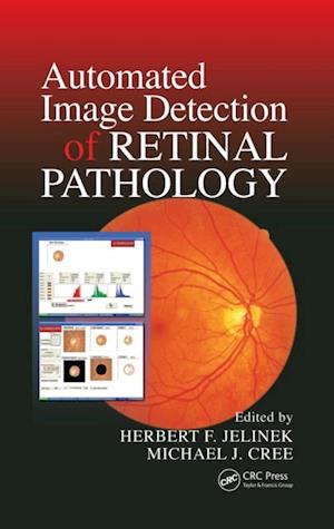 Automated Image Detection of Retinal Pathology