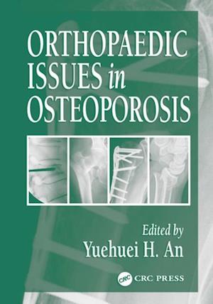 Orthopaedic Issues in Osteoporosis