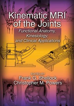 Kinematic MRI of the Joints