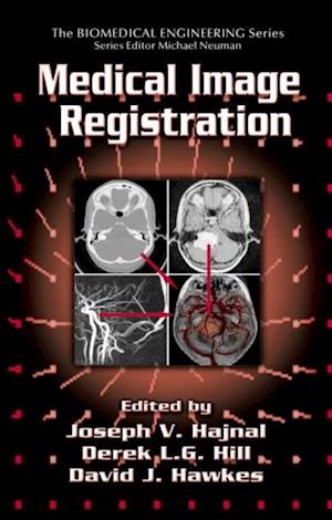 Medical Image Registration