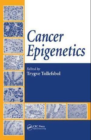 Cancer Epigenetics