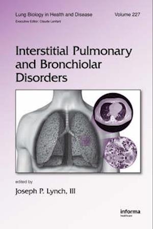 Interstitial Pulmonary and Bronchiolar Disorders