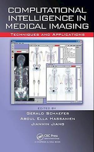 Computational Intelligence in Medical Imaging