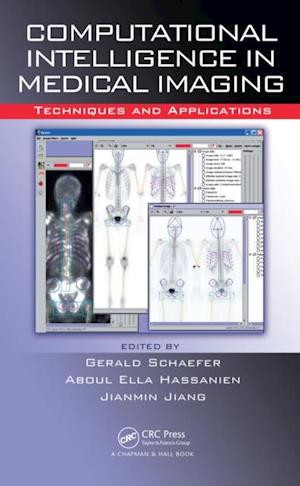 Computational Intelligence in Medical Imaging