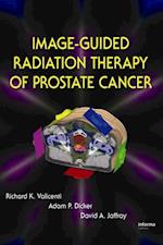 Image-Guided Radiation Therapy of Prostate Cancer