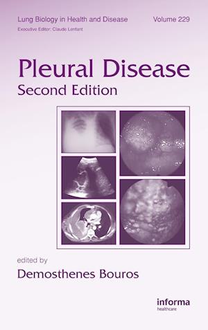 Pleural Disease