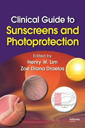 Clinical Guide to Sunscreens and Photoprotection