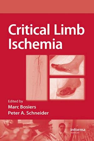 Critical Limb Ischemia