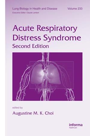 Acute Respiratory Distress Syndrome