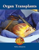 Organ Transplants