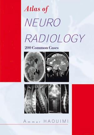 Atlas of Neuroradiology