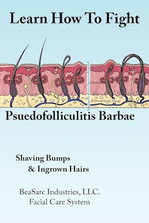 Learn How To Fight Psuedofolliculitis Barbae
