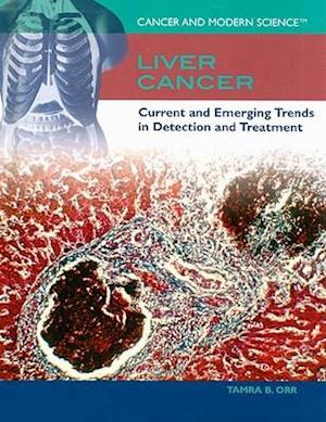 Liver Cancer