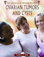 Ovarian Tumors and Cysts