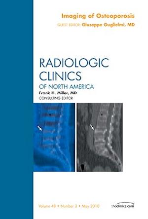 Imaging of Osteoporosis, An Issue of Radiologic Clinics of North America