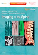 Imaging of the Spine E-Book