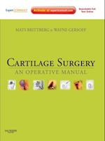 Cartilage Surgery