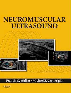 Neuromuscular Ultrasound