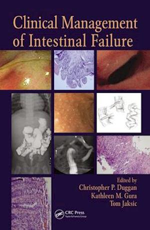 Clinical Management of Intestinal Failure