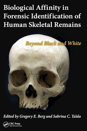 Biological Affinity in Forensic Identification of Human Skeletal Remains