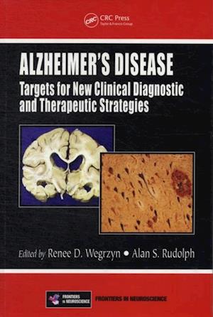 Alzheimer''s Disease